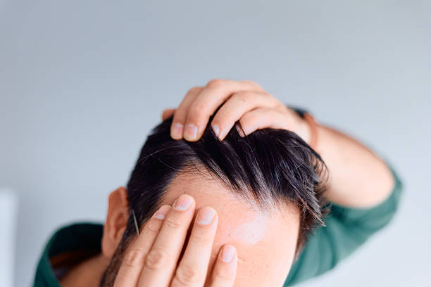 exosomes for hair price in ksa