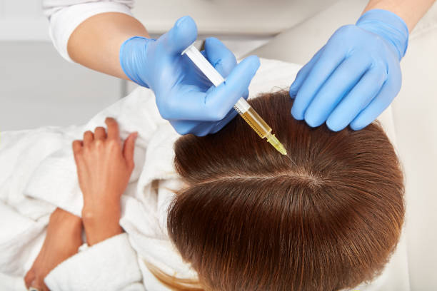 prp hair treatment riyadh